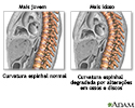 Mudanças na coluna vertebral com a idade