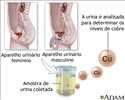 Exame de cobre urinário