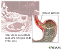Prevenção da azia