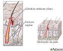 Anatomia de um folículo capilar