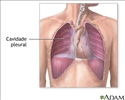 Cavidade pleural