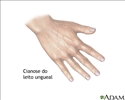 Cianose da base da unha