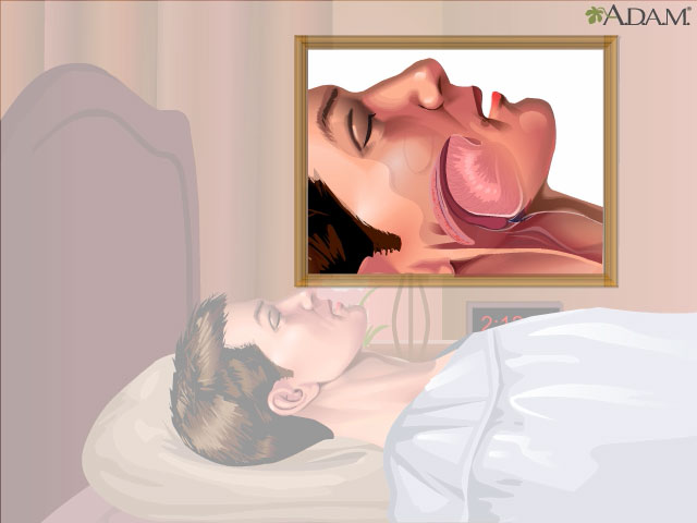 Snoring