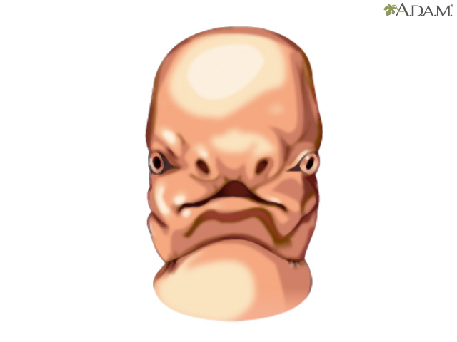 Human face formation