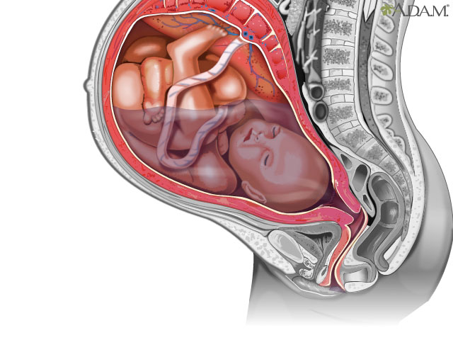 Rupturing membranes