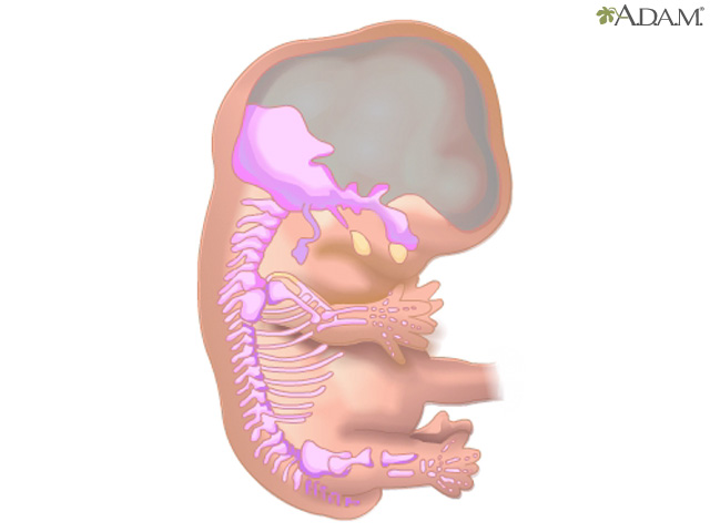 Skeletal formation