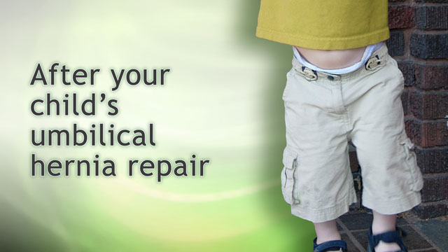 After your child's umbilical hernia repair