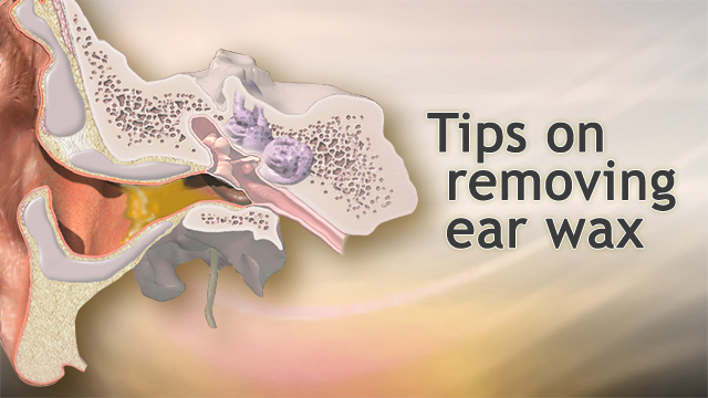 Tips on removing ear wax
