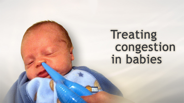 Treating congestion in babies