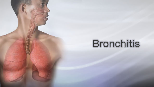 Bronchitis acute Information Mount Sinai New York