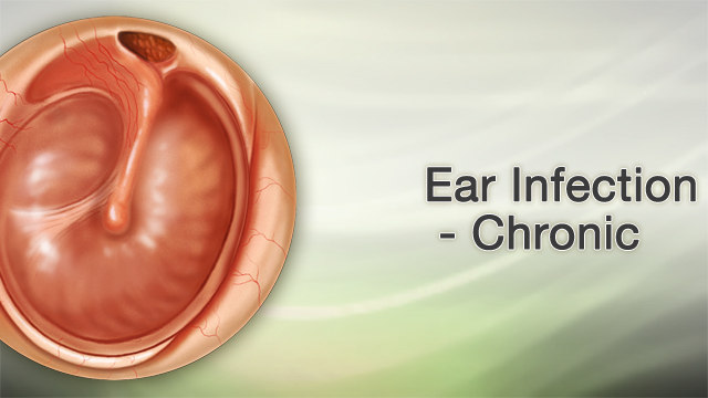 Ear infection - chronic