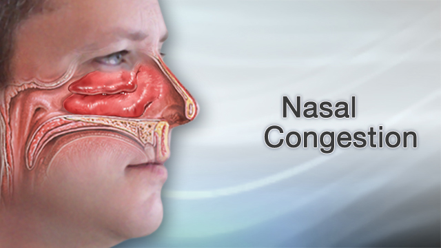 heavy nasal congestion