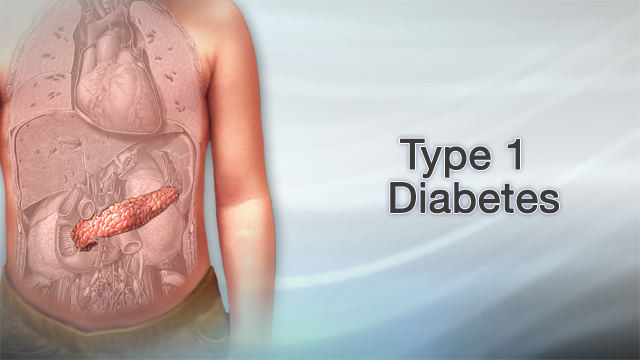 Type 1 diabetes Information | Mount Sinai - New York