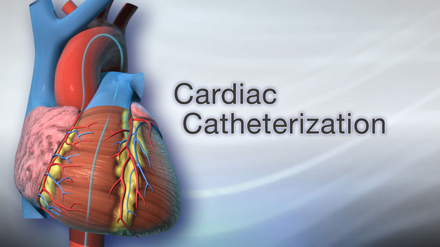 Cardiac catheterization