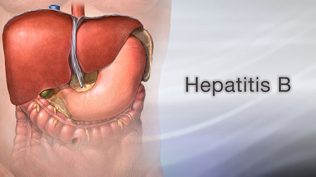 Hepatitis B Information Mount Sinai New York