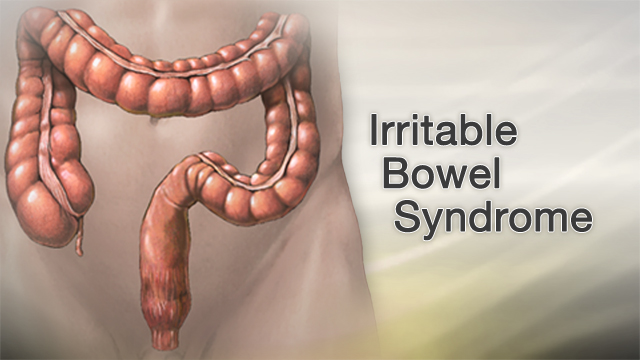 Irritable bowel syndrome