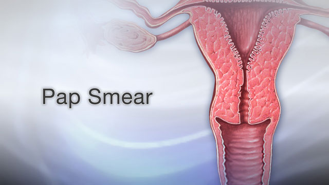 pap smear procedure steps