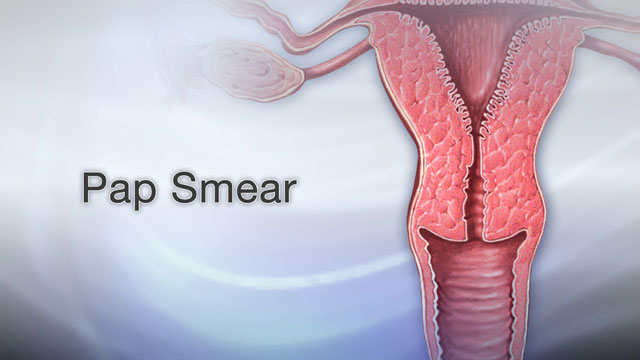 Pap smear