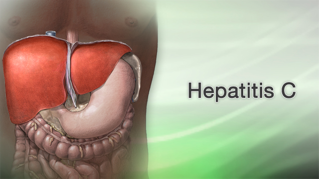 Hepatitis C Information