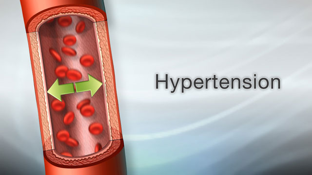 Hypertension