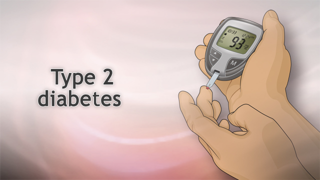 Type 2 diabetes