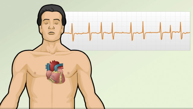 Cardiac arrhythmia symptoms