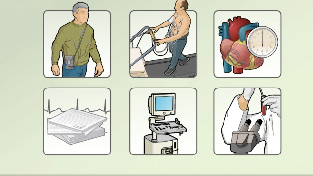 Cardiac arrhythmia: Additional tests