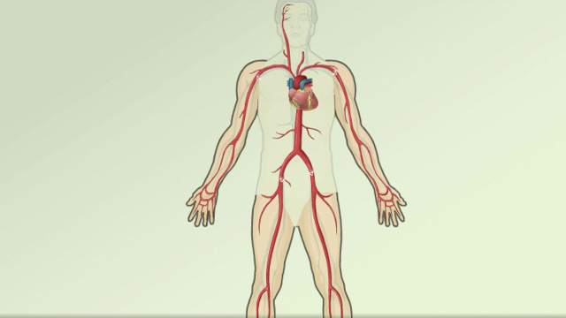 Congestive heart failure (CHF) overview