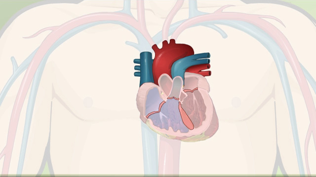 Congenital heart defects (CHD) - Blood flow