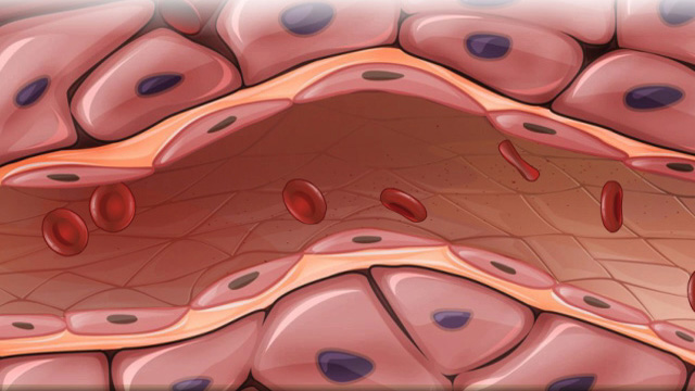 Hypertension overview