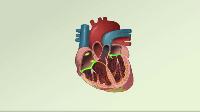 Cardiac conduction system disorders - overview