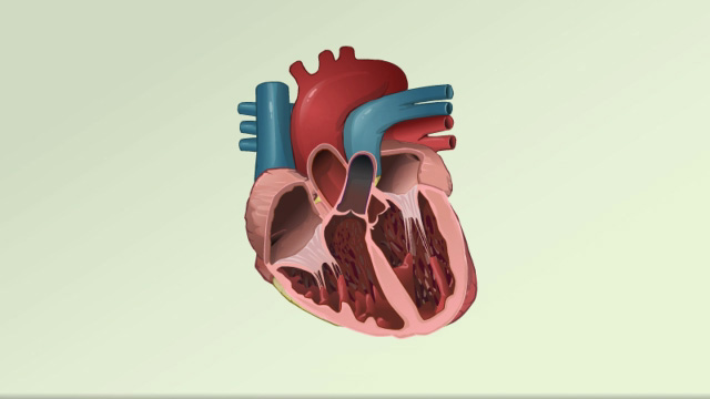 Ventricular fibrillation and tachycardia