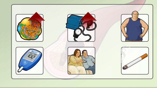 Heart disease - modifiable risk factor types 