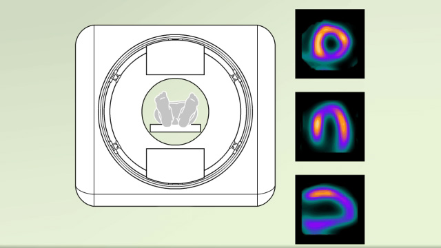 Nuclear heart scan overview