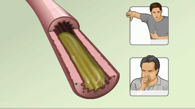 
Asthma symptoms, triggers, and management