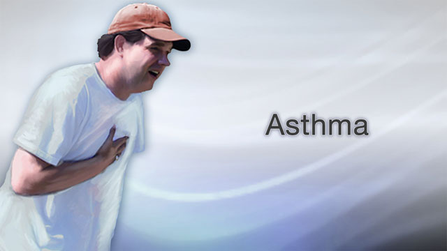 Asthma