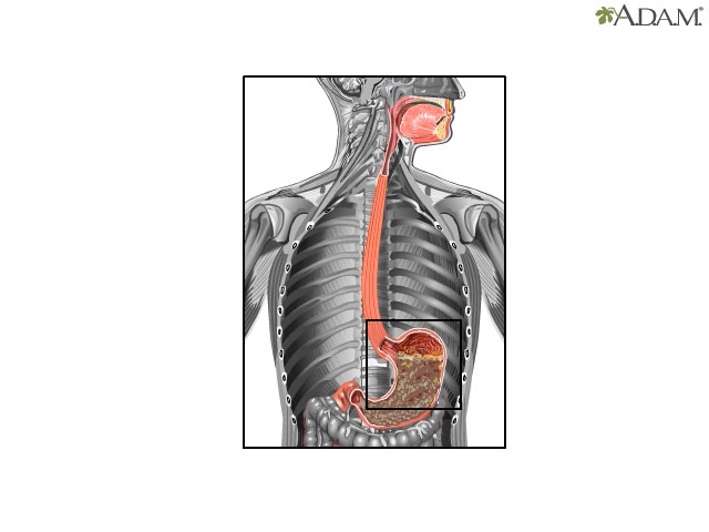 Peristalsis