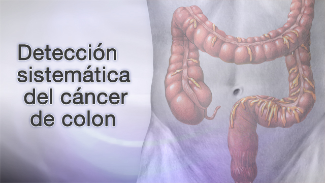 Detección sistemática del cáncer de colon