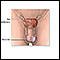 Anatomía reproductora masculina