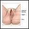 Reparación anterior de la vagina (incontinencia urinaria - tratamiento quirúrgico) - serie