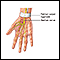 Carpal tunnel repair - Series