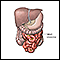 Divertículo de Meckel - anatomía normal