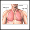 Lobectomía pulmonar - serie - Anatomía normal