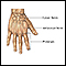 Repair of webbed fingers - series