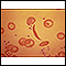 Glóbulos vermelhos, célula falsiforme