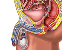 Enlarged prostate gland - Animation
                    
