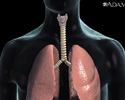 Cancer of the throat or larynx - Video
                                      