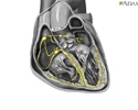 Sistema de conducción cardíaco - Animación
                    