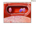 Immune response - Animation
                    