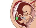 Kids - Umbilical cord - Animation
                    